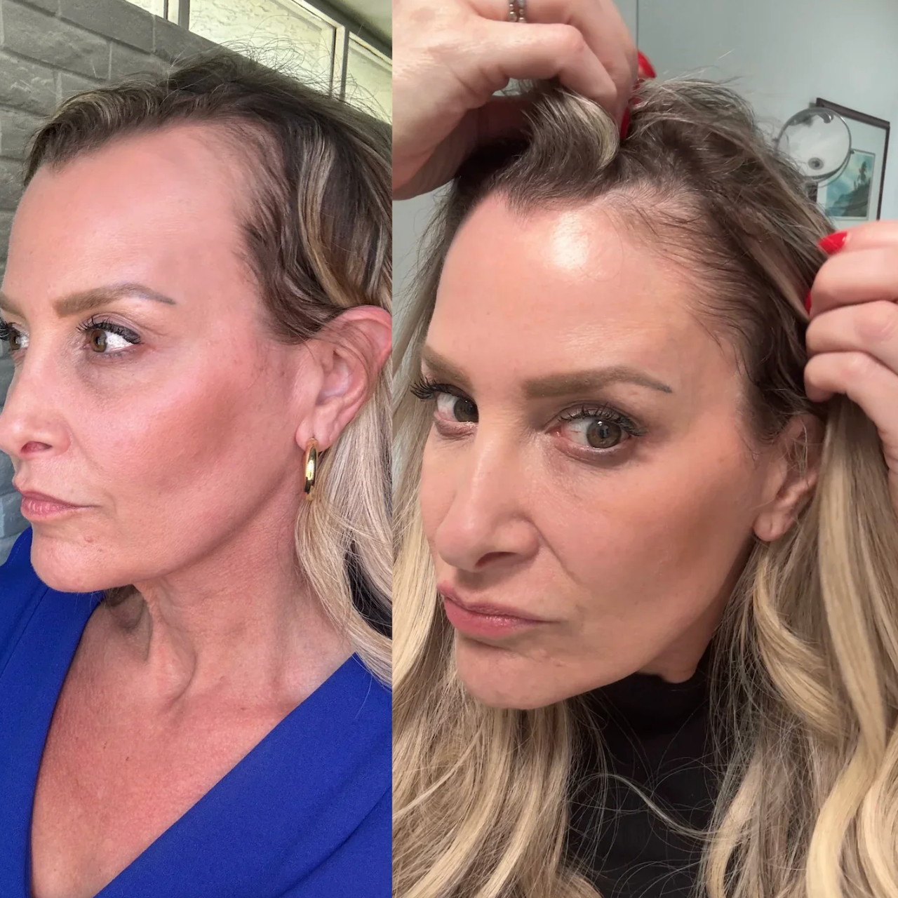 Hair Growth Serum