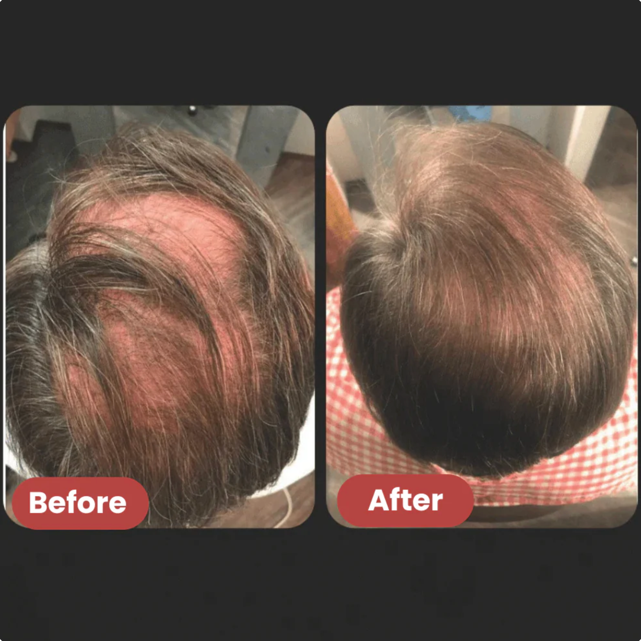 Hair Growth Serum