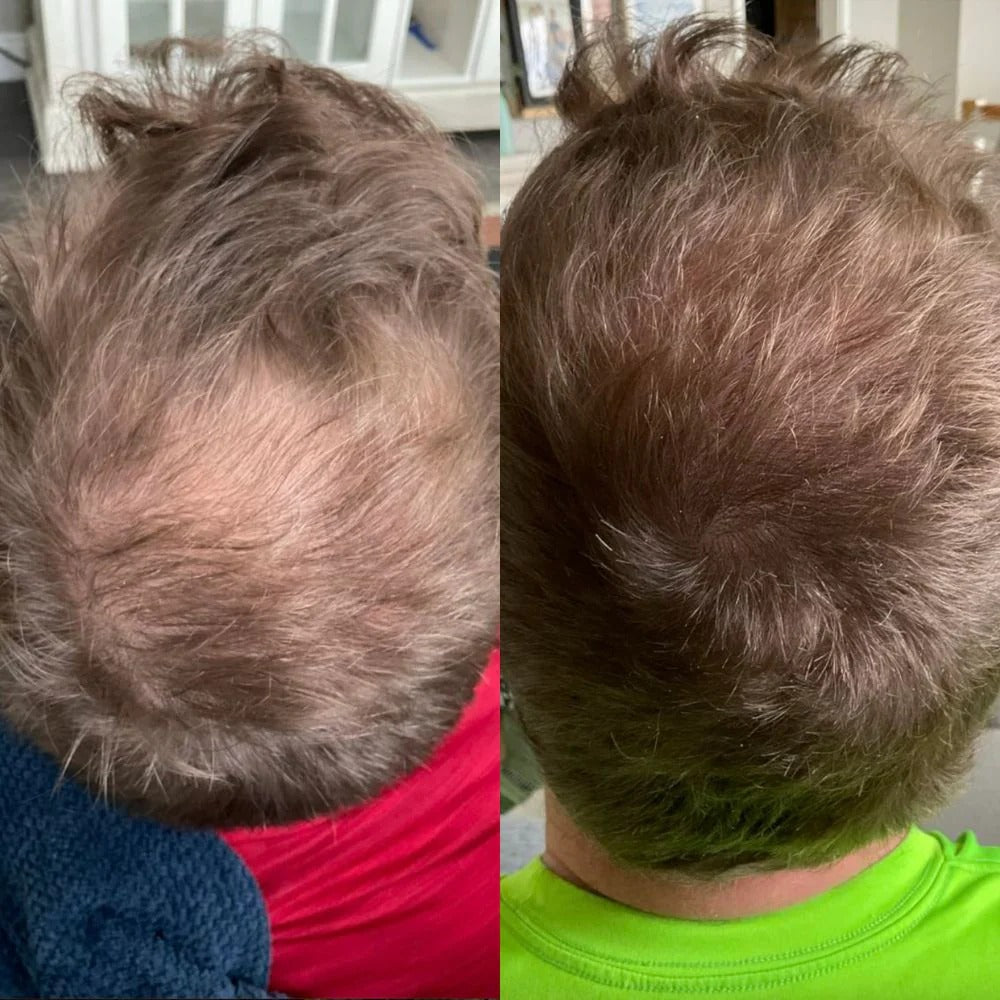 Hair Growth Serum