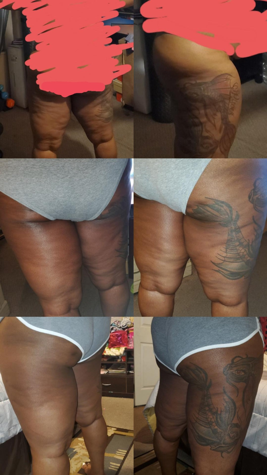 Anti-Cellulit Massage